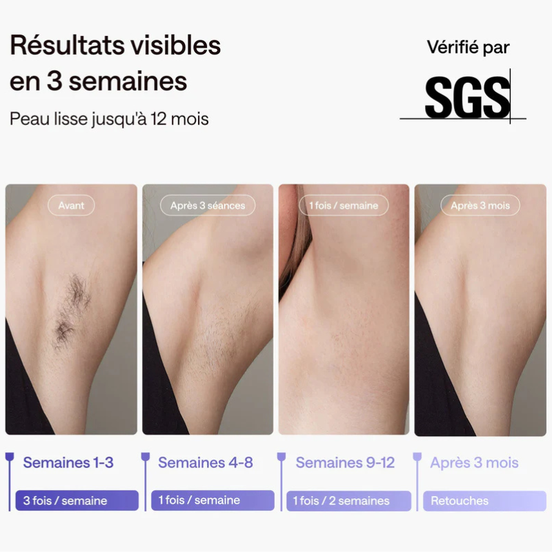 SILARA IPL